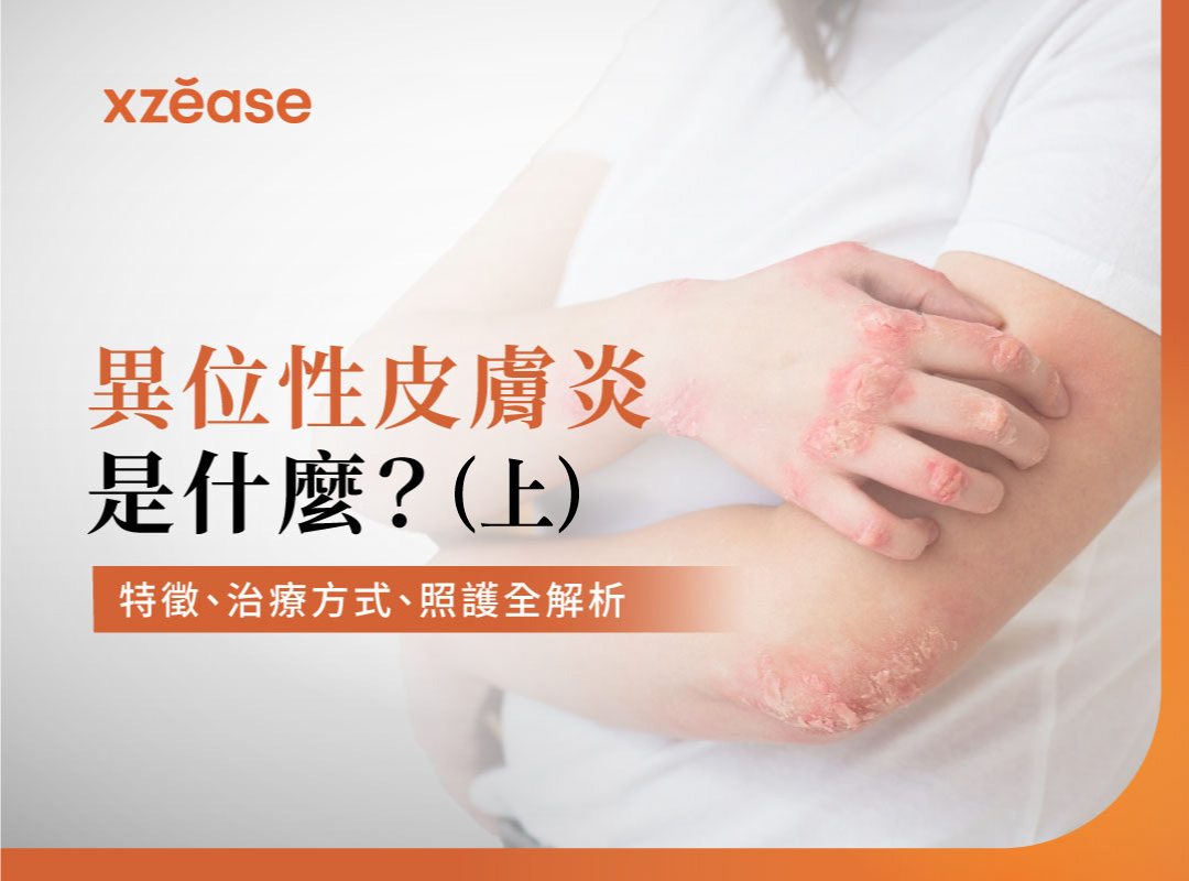 異位性皮膚炎：症狀、原因及護理(上)