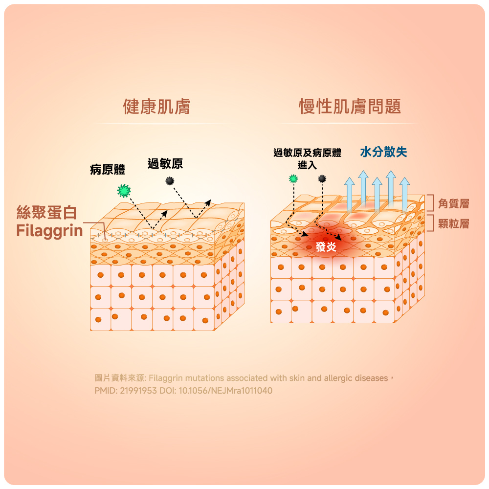 問題肌膚的成因